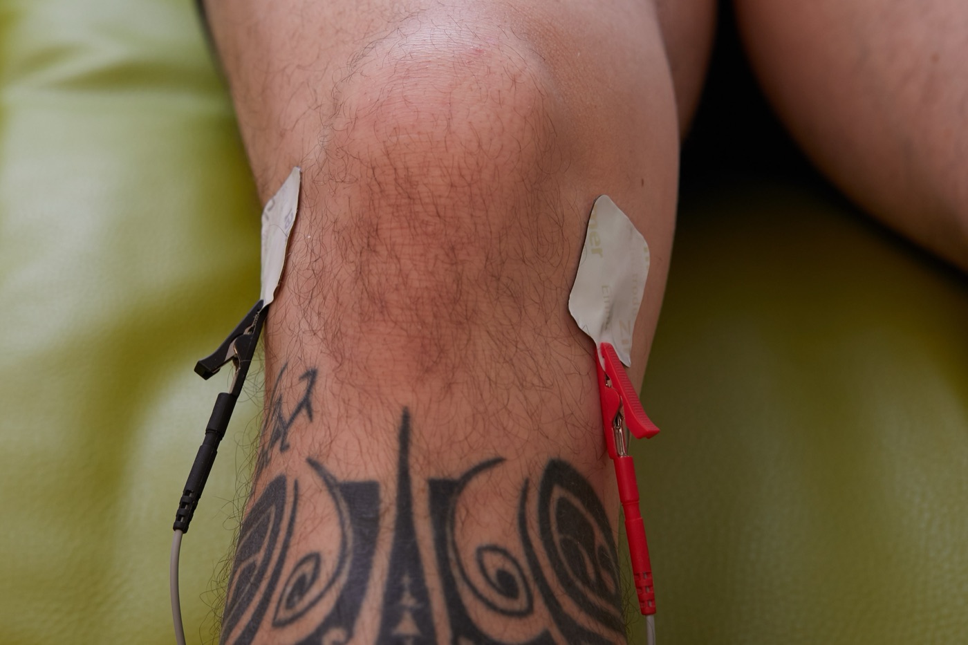 Elektrotherapie